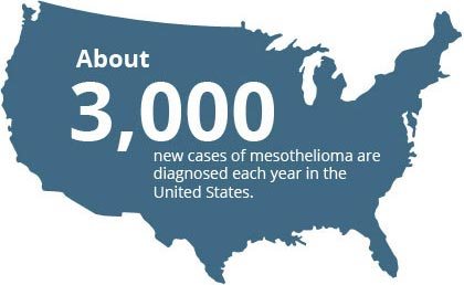 Mesothelioma Facts and Statistics