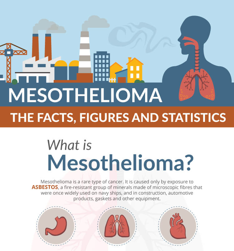 Mesothelioma Stats 2017 Infographics