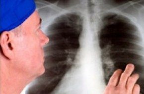 Chest Cold May Sign of Mesothelioma | Mesothelioma Help