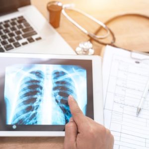 Mesothelioma Life Expectancy How Long Do Patients Live? Mesothelioma Life Expectancy How Long Do Patients Live?