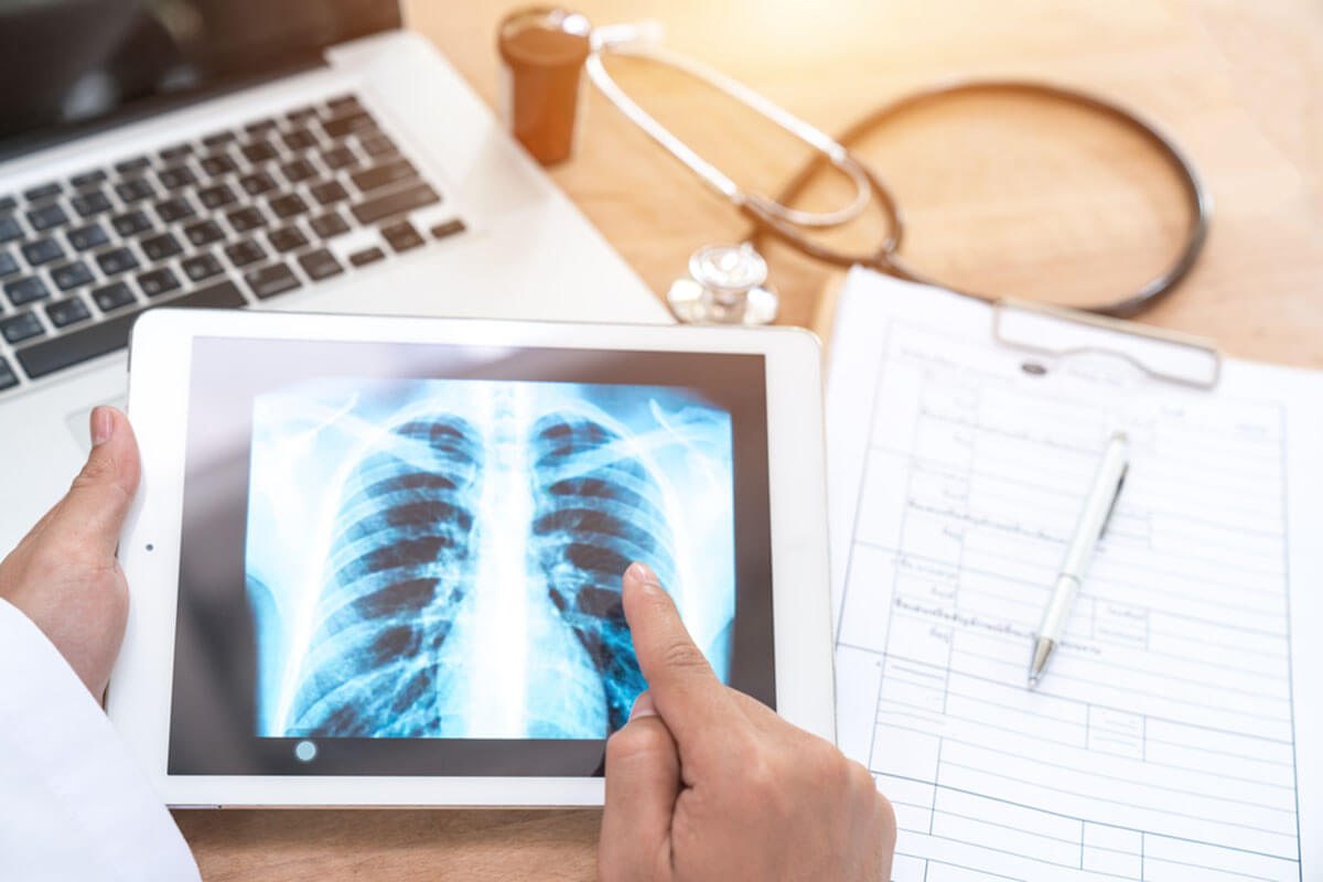 fibrous malignant mesothelioma