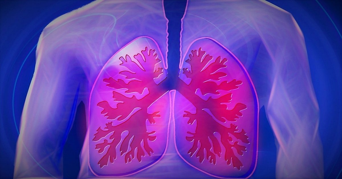 Mesothelioma Treatment from Aggressive Lung Cancer