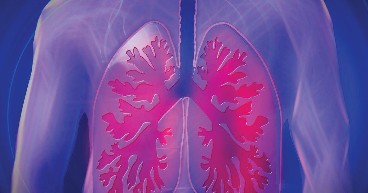 Oxygen-Focused Treatment - Mesothelioma