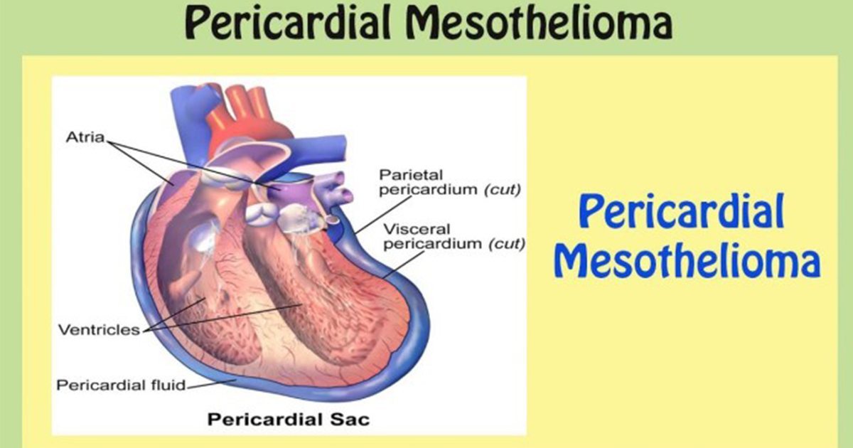 car t therapy mesothelioma