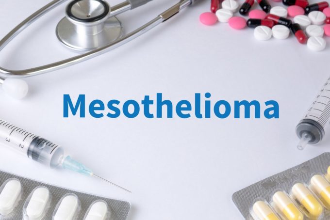 peritoneal mesothelioma test