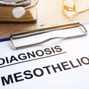 sacromatoid mesothelioma diagnosis