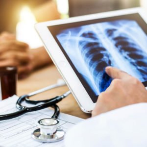 Mesothelioma Specialist