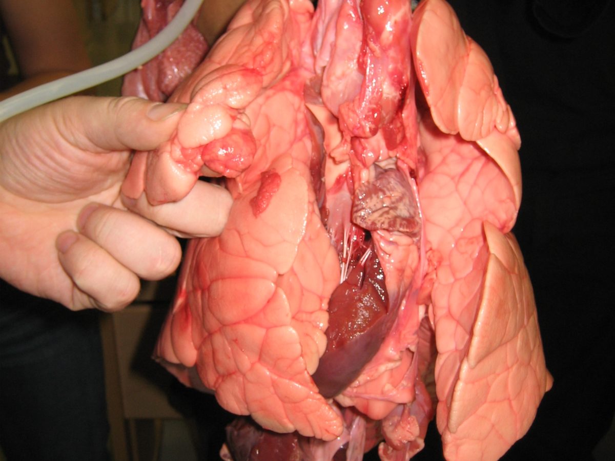 growth of malignant pleural mesothelioma